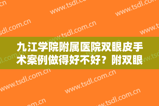 九江学院附属医院双眼皮手术案例做得好不好？附双眼皮手术案例分享！
