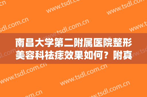 南昌大学第二附属医院整形美容科祛痣效果如何？附真人祛痣术后图(南昌大学第二附属医院点痣多少钱)