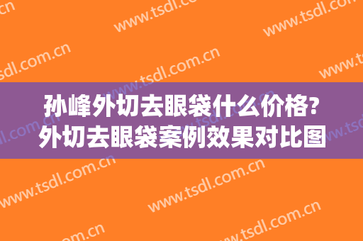 孙峰外切去眼袋什么价格?外切去眼袋案例效果对比图_西安国际医学中心医院