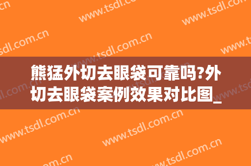 熊猛外切去眼袋可靠吗?外切去眼袋案例效果对比图_东南大学附属中大医院