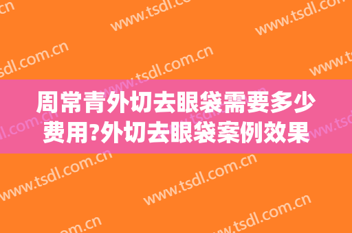 周常青外切去眼袋需要多少费用?外切去眼袋案例效果对比图_北京大学第一医院