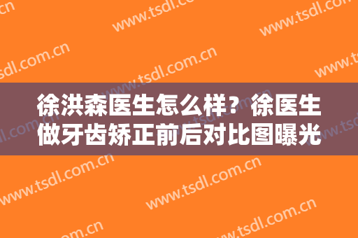 徐洪森医生怎么样？徐医生做牙齿矫正前后对比图曝光！2024价格表附上