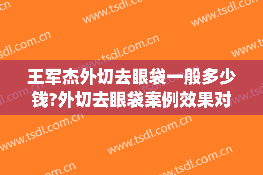 王军杰外切去眼袋一般多少钱?外切去眼袋案例效果对比图_河南省直第三人民医院