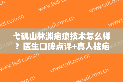 弋矶山林渊疤痕技术怎么样？医生口碑点评+真人祛疤术后反馈图！