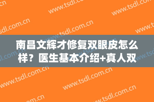 南昌文辉才修复双眼皮怎么样？医生基本介绍+真人双眼皮反馈图！(林昌辉修复双眼皮怎么样)