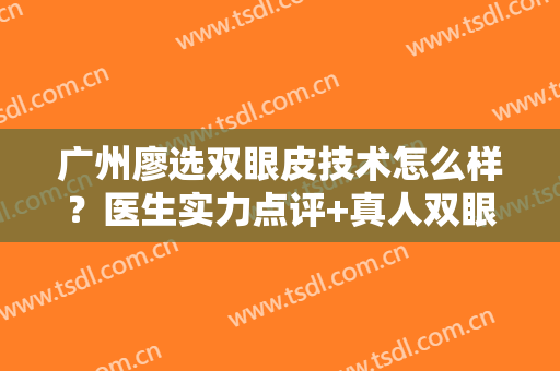 广州廖选双眼皮技术怎么样？医生实力点评+真人双眼皮案例效果参考~