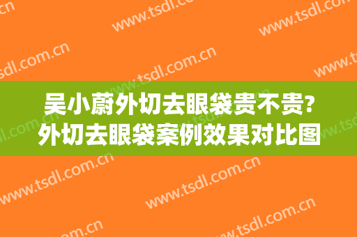 吴小蔚外切去眼袋贵不贵?外切去眼袋案例效果对比图_武汉大学人民医院