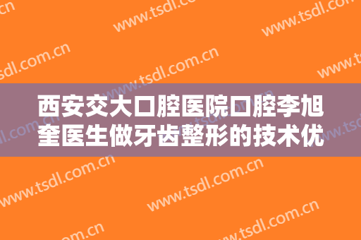 西安交大口腔医院口腔李旭奎医生做牙齿整形的技术优势分析！附牙整形案例