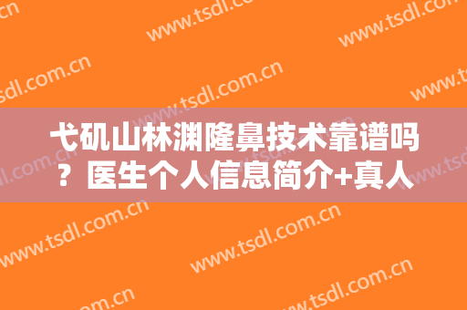 弋矶山林渊隆鼻技术靠谱吗？医生个人信息简介+真人隆鼻效果图！