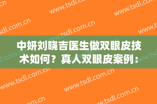 中妍刘晓吉医生做双眼皮技术如何？真人双眼皮案例：后悔没早来！(中妍双眼皮做的怎样)