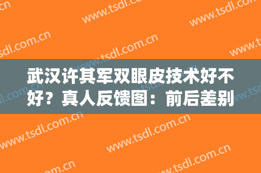 武汉许其军双眼皮技术好不好？真人反馈图：前后差别比较大！(武汉任军双眼皮毁了)