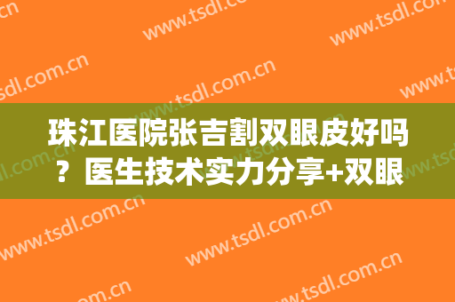 珠江医院张吉割双眼皮好吗？医生技术实力分享+双眼皮术后效果反馈(珠江医院双眼皮手术)