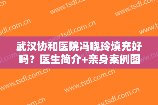 武汉协和医院冯晓玲填充好吗？医生简介+亲身案例图分享！