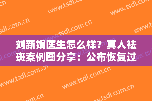 刘新娟医生怎么样？真人祛斑案例图分享：公布恢复过程！