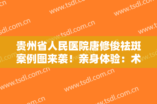 贵州省人民医院唐修俊祛斑案例图来袭！亲身体验：术后一个月效果惊艳