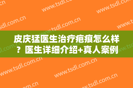 皮庆猛医生治疗疤痕怎么样？医生详细介绍+真人案例展示