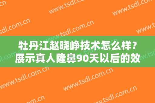 牡丹江赵晓峥技术怎么样？展示真人隆鼻90天以后的效果！超级不错！