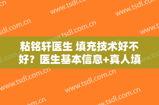 粘铭轩医生 填充技术好不好？医生基本信息+真人填充案例图分享、1