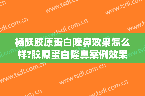杨跃胶原蛋白隆鼻效果怎么样?胶原蛋白隆鼻案例效果对比图_浙江省中医院