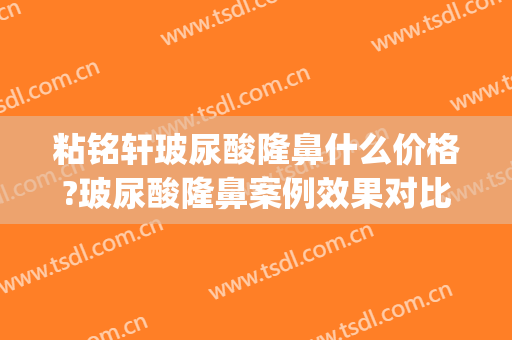 粘铭轩玻尿酸隆鼻什么价格?玻尿酸隆鼻案例效果对比图_北京大学深圳医院