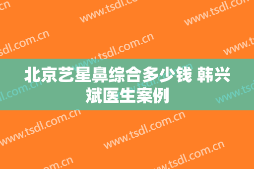 北京艺星鼻综合多少钱 韩兴斌医生案例