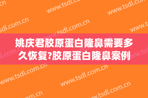 姚庆君胶原蛋白隆鼻需要多久恢复?胶原蛋白隆鼻案例效果对比图_天津市第三中心医院
