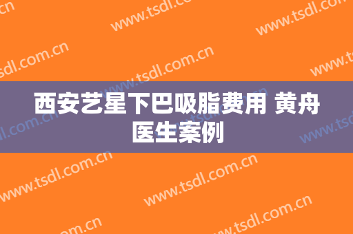 西安艺星下巴吸脂费用 黄舟医生案例