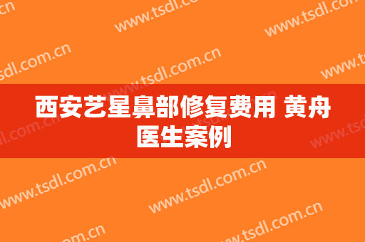 西安艺星鼻部修复费用 黄舟医生案例