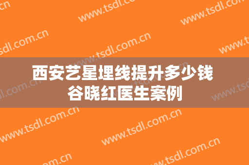西安艺星埋线提升多少钱 谷晓红医生案例