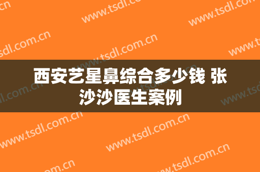 西安艺星鼻综合多少钱 张沙沙医生案例