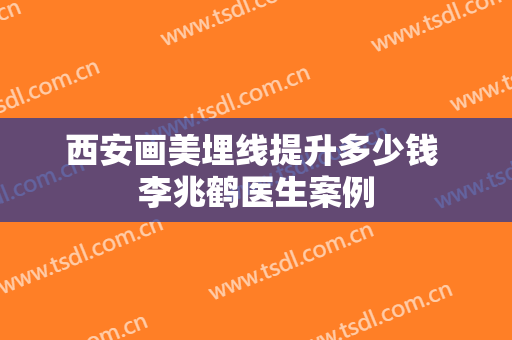 西安画美埋线提升多少钱 李兆鹤医生案例