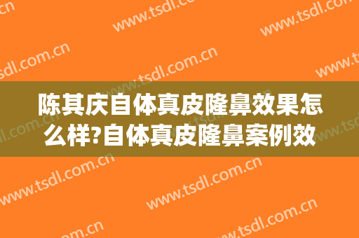 陈其庆自体真皮隆鼻效果怎么样?自体真皮隆鼻案例效果对比图_南方医科大学南方医院