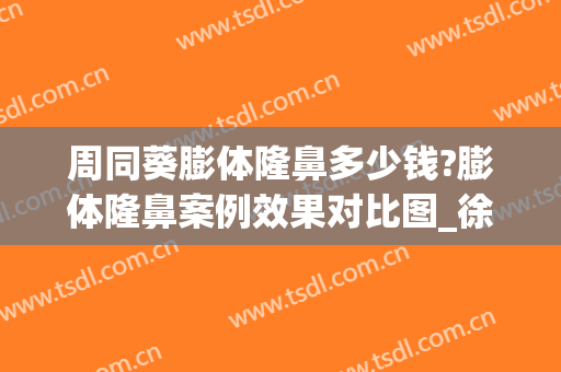 周同葵膨体隆鼻多少钱?膨体隆鼻案例效果对比图_徐州市中心医院