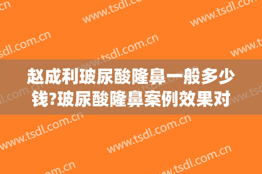 赵成利玻尿酸隆鼻一般多少钱?玻尿酸隆鼻案例效果对比图_广东省人民医院