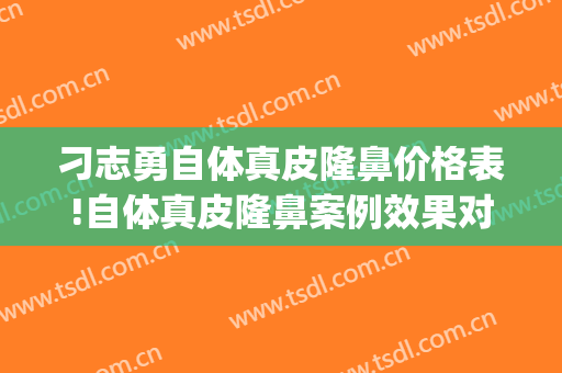 刁志勇自体真皮隆鼻价格表!自体真皮隆鼻案例效果对比图_哈尔滨医科大学附属第一医院