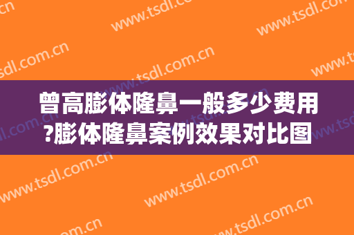 曾高膨体隆鼻一般多少费用?膨体隆鼻案例效果对比图_中日友好医院(膨体隆鼻一般价位是多少)