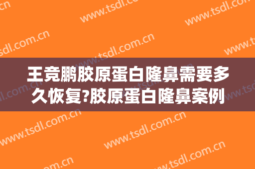 王竞鹏胶原蛋白隆鼻需要多久恢复?胶原蛋白隆鼻案例效果对比图_青岛市中心医院