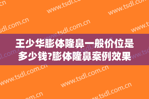 王少华膨体隆鼻一般价位是多少钱?膨体隆鼻案例效果对比图_潍坊市人民医院