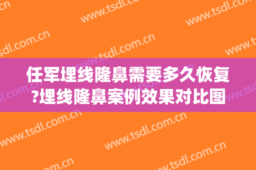 任军埋线隆鼻需要多久恢复?埋线隆鼻案例效果对比图_武汉市第三医院