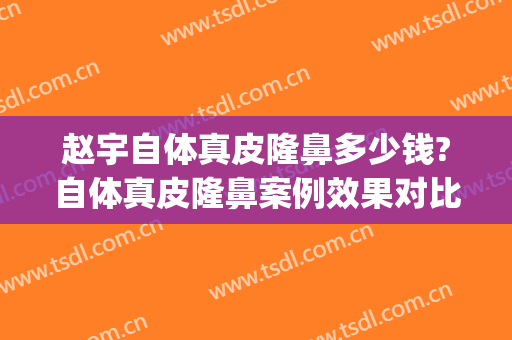 赵宇自体真皮隆鼻多少钱?自体真皮隆鼻案例效果对比图_中国医科大学附属盛京医院