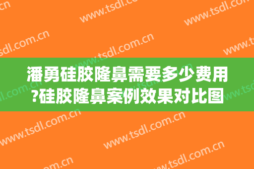 潘勇硅胶隆鼻需要多少费用?硅胶隆鼻案例效果对比图_好大夫工作室(合资硅胶隆鼻多少钱)