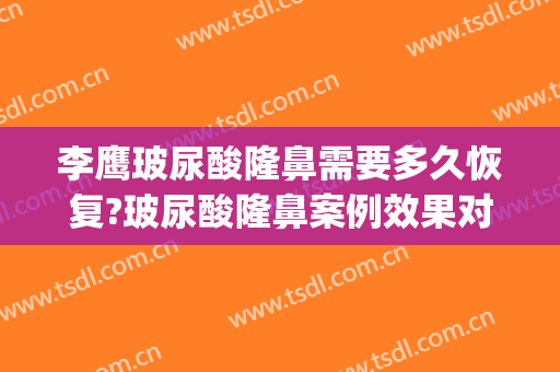 李鹰玻尿酸隆鼻需要多久恢复?玻尿酸隆鼻案例效果对比图_济宁医学院附属医院