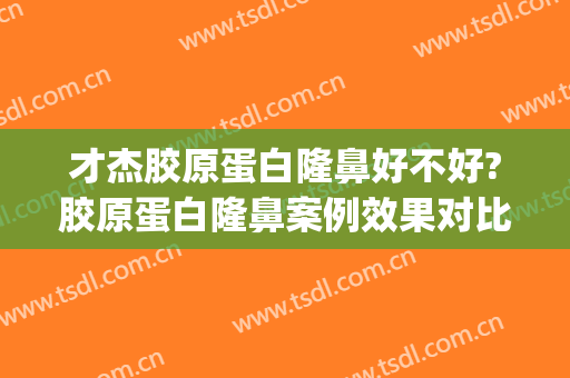 才杰胶原蛋白隆鼻好不好?胶原蛋白隆鼻案例效果对比图_中日友好医院