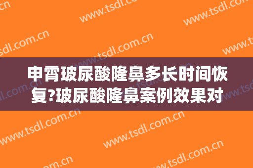 申霄玻尿酸隆鼻多长时间恢复?玻尿酸隆鼻案例效果对比图_重庆医科大学附属第一医院