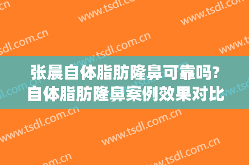 张晨自体脂肪隆鼻可靠吗?自体脂肪隆鼻案例效果对比图_大连大学附属新华医院