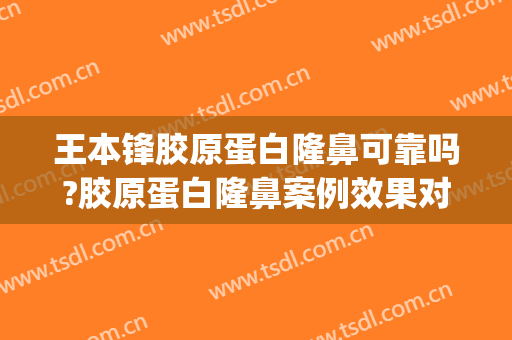 王本锋胶原蛋白隆鼻可靠吗?胶原蛋白隆鼻案例效果对比图_陕西省人民医院