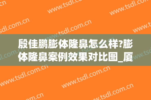 殷佳鹏膨体隆鼻怎么样?膨体隆鼻案例效果对比图_厦门大学附属第一医院