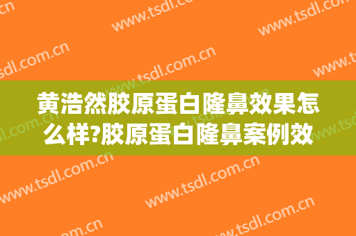 黄浩然胶原蛋白隆鼻效果怎么样?胶原蛋白隆鼻案例效果对比图_南方医科大学南方医院