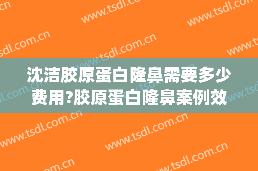 沈洁胶原蛋白隆鼻需要多少费用?胶原蛋白隆鼻案例效果对比图_陆军军医大学第一附属医院