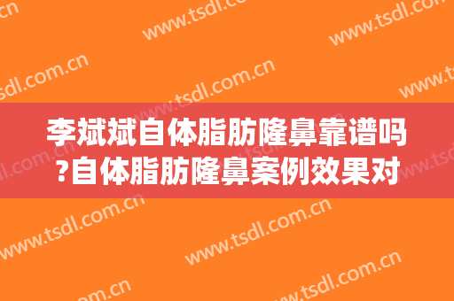李斌斌自体脂肪隆鼻靠谱吗?自体脂肪隆鼻案例效果对比图_首都医科大学附属北京安贞医院